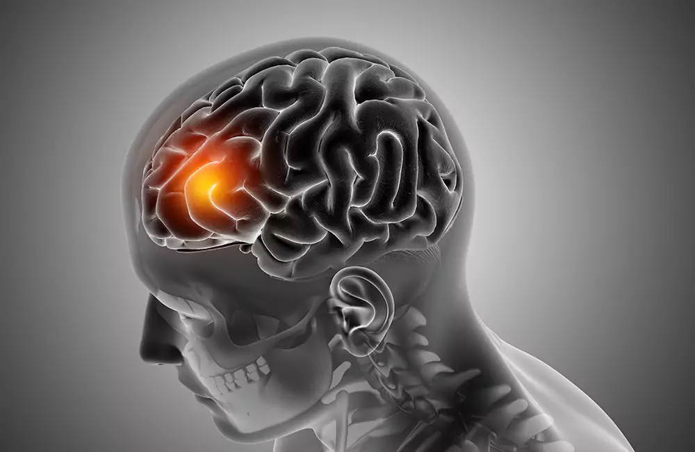 Brain Tumor